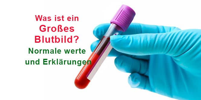 Was ist ein Großes Blutbild? Normale werte und Erklärungen