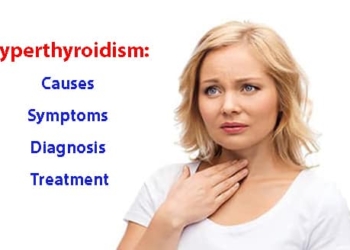Hyperthyroidism: Causes, symptoms, diagnosis and treatment
