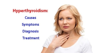 Hyperthyroidism: Causes, symptoms, diagnosis and treatment