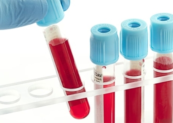 Что такое гемограмма? Нормальные показатели общего анализа крови