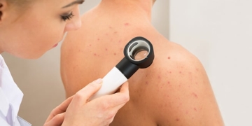 Что такое дерматология? Кожные заболевания и лечение