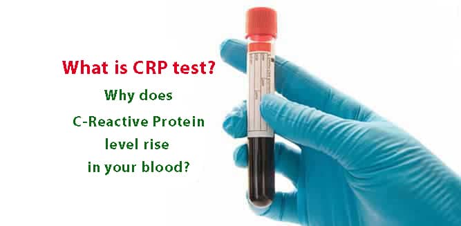 What Is Crp Test Why Does C Reactive Protein Level Rise In Your Blood