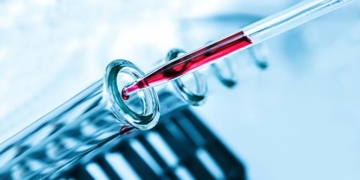 Platelet Rich Plasma (PRP) In IVF (In Vitro Fertilization)