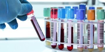 What are platelets? What are the problems of low and high PLT?