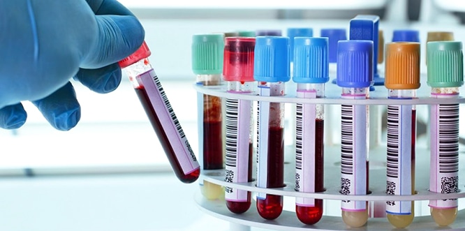 You are currently viewing What are platelets? What are the problems of low and high PLT?