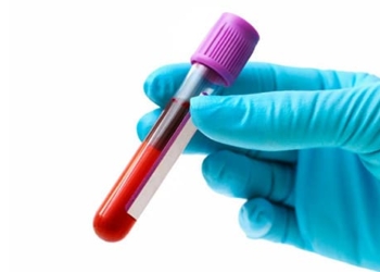 Что такое гипогликемия? Причины, симптомы и лечение