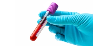 Что такое гипогликемия? Причины, симптомы и лечение