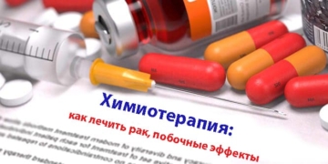Химиотерапия: как лечить рак, побочные эффекты
