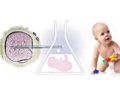 In Vitro Fertilization (IVF): Treatment steps, success rate and risks