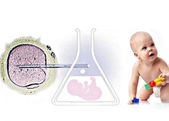 In Vitro Fertilization (IVF): Treatment steps, success rate and risks