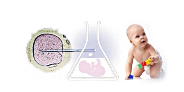 In Vitro Fertilization (IVF): Treatment steps, success rate and risks