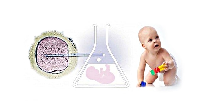 You are currently viewing In Vitro Fertilization (IVF): Treatment steps, success rate and risks