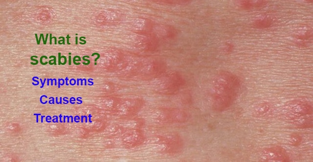 home remedies for distended stomach