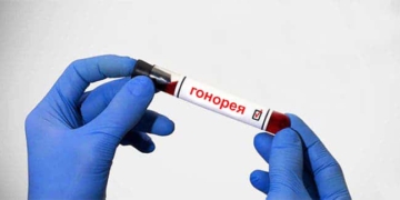 Что такое гонорея? Симптомы, лечение и профилактика