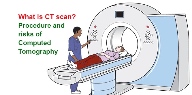 What Is Ct Scan Procedure Types And Risks Of Computed Tomography
