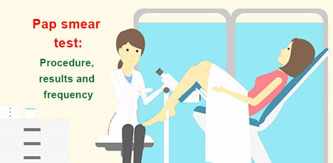 What Is A Pap Smear Test Procedure Results And Frequency