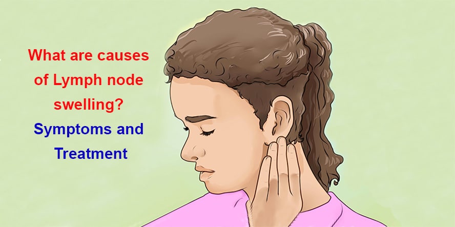 What Are Causes Of Lymph Node Swelling Symptoms And Treatment