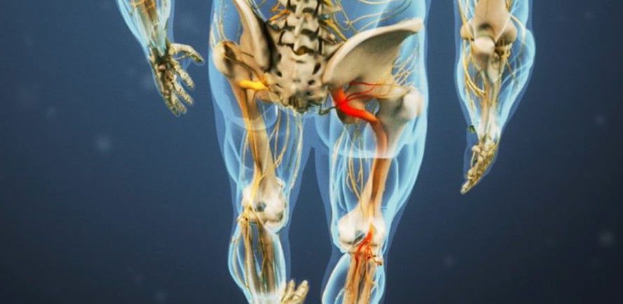Read more about the article Sciatica Pain Guide: Symptoms, Causes, Treatments, and Exercise