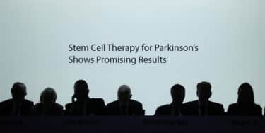 Read more about the article Bemdaneprocel: Stem Cell Therapy for Parkinson’s Shows Promising Results