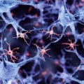 Stanford Study: Stem Cell Therapy Shows Promise in Alzheimer’s Treatment