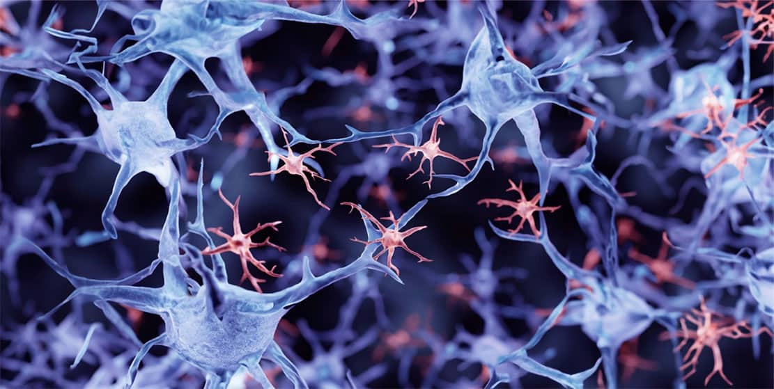 Read more about the article Stanford Study: Stem Cell Therapy Shows Promise in Alzheimer’s Treatment