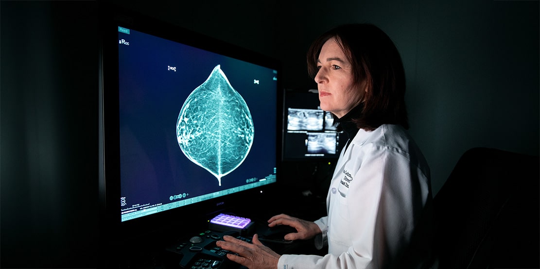 You are currently viewing Faster and More Accurate: AI Boosts Success in Breast Cancer Detection